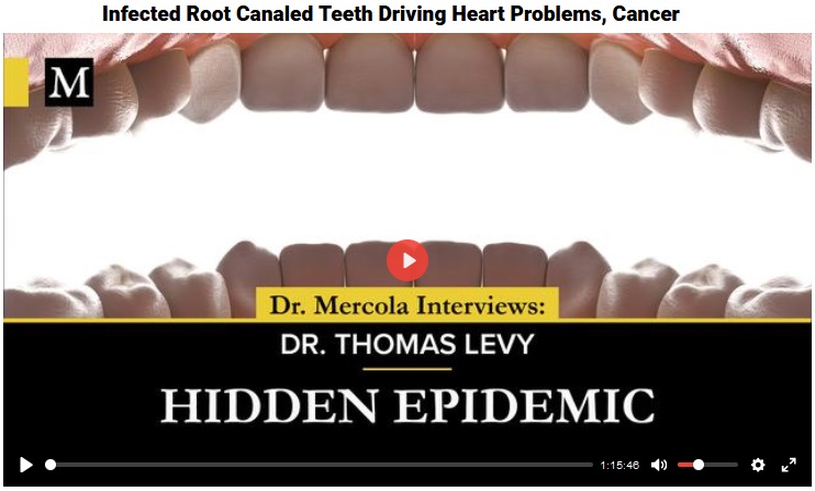 oral health; Mercola, Levy